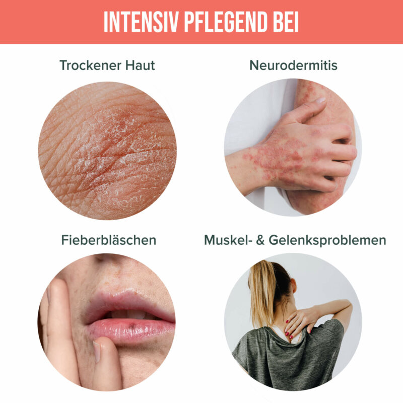 Repair Balm - limitiertes Probierangebot 7 CBD Repair Balm Anwendung