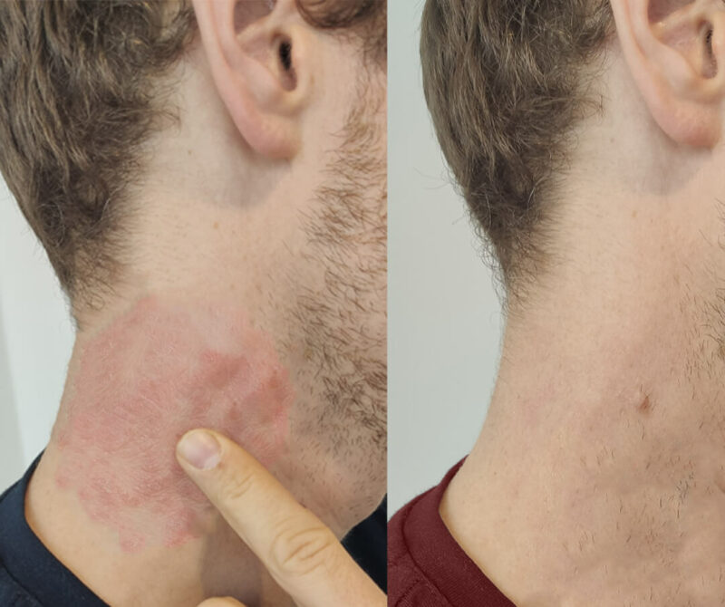 Repair Balm - limitiertes Probierangebot 10 Vorher Nachher Steffen R